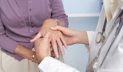 sinusuri ng doktor ang mga kasukasuan ng mga kamay na may arthrosis at arthritis