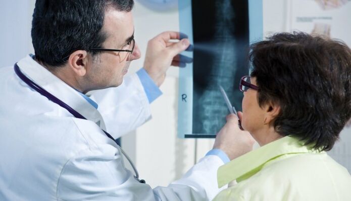 x-ray ng gulugod na may osteochondrosis