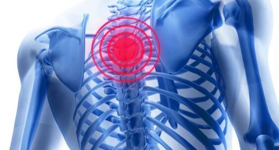 Paggamot ng osteochondrosis ng thoracic spine