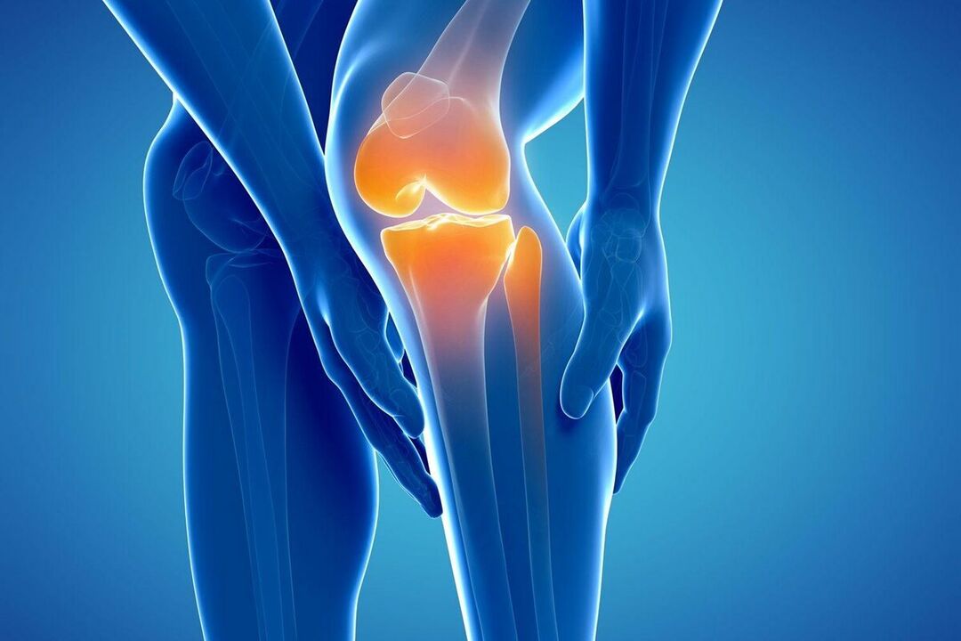 Ano ang arthrosis