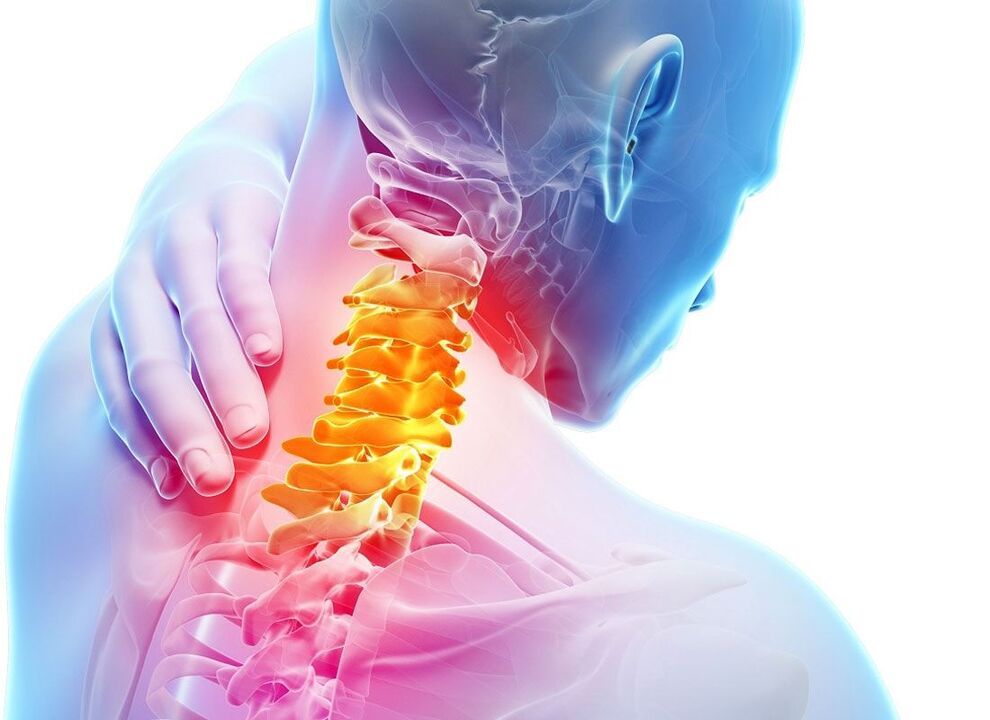 lokalisasyon ng osteochondrosis