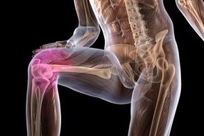 pananakit ng kasukasuan dahil sa arthrosis ng tuhod